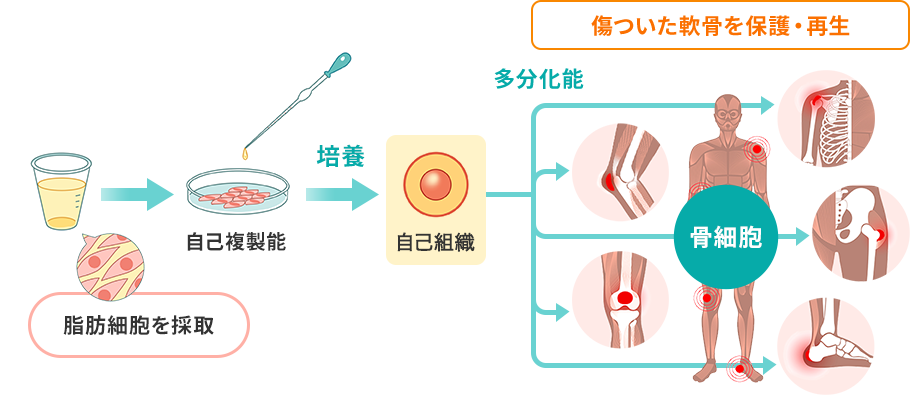 自己組織仕組み