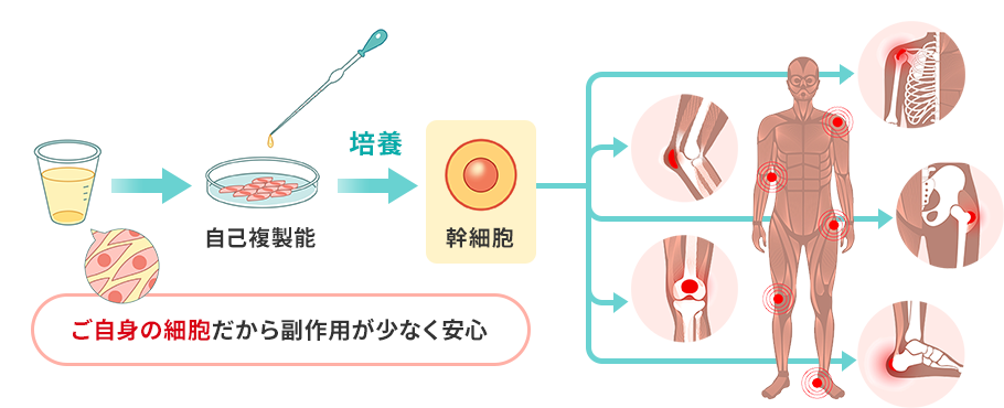 『自己組織』で損傷した部位を修復する